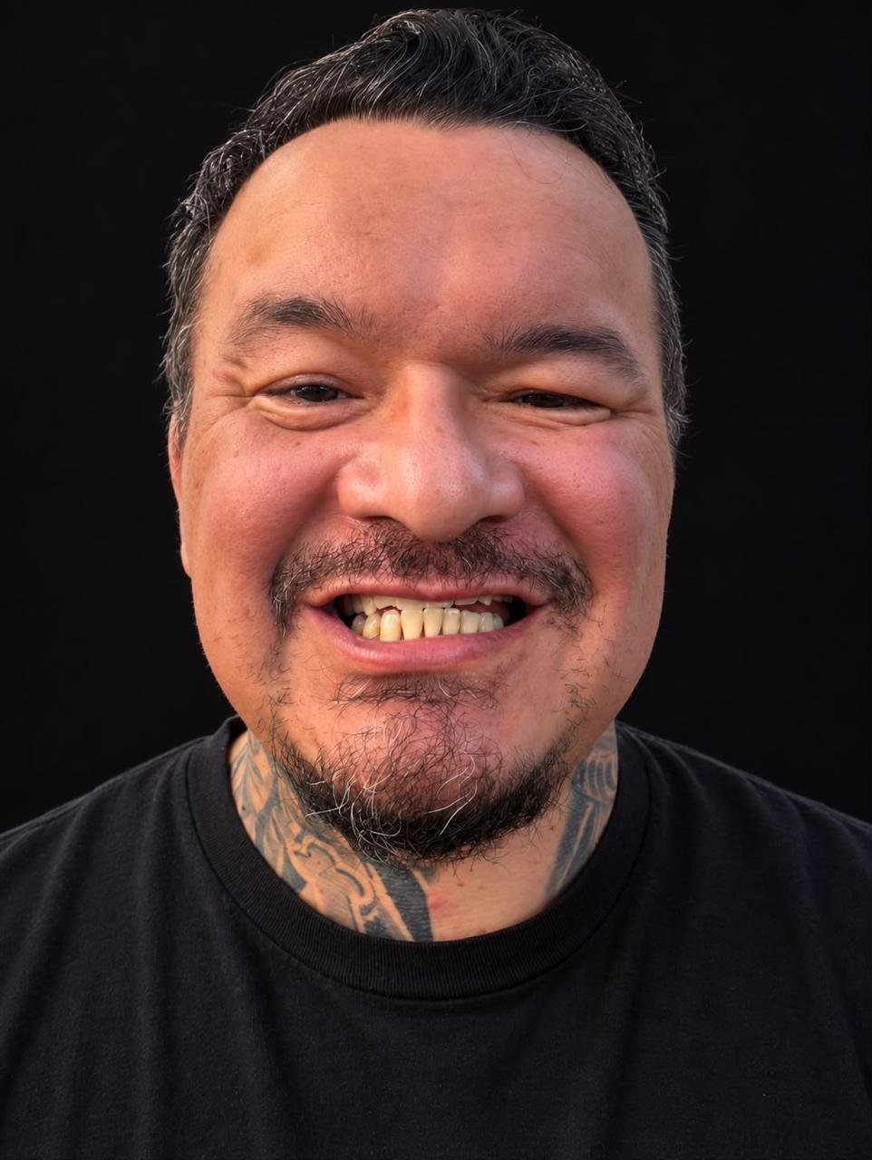Dr. Borboa smile transformation 18